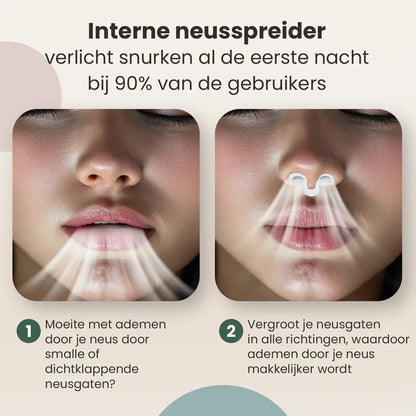 Complete 4-in-1 Snurk Set
