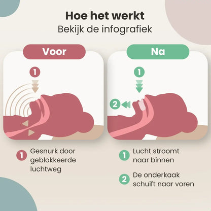 Snurkbeugel Vrouw